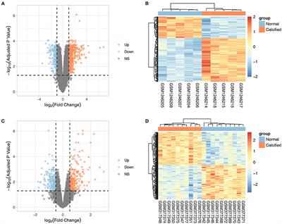 Identification of Key Non-coding RNAs and Transcription Factors in Calcific Aortic Valve Disease